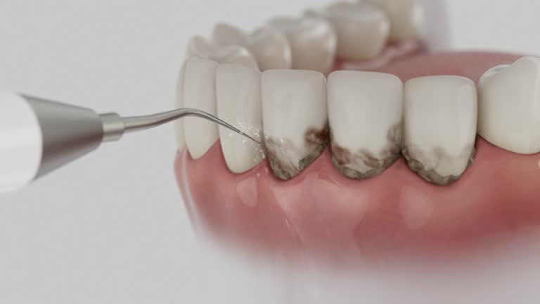 Reliable Dental contractor in Coralville, IA by Dentist Open Now